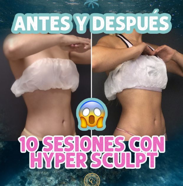 Blog 5 hyper 1 - foreverplaya